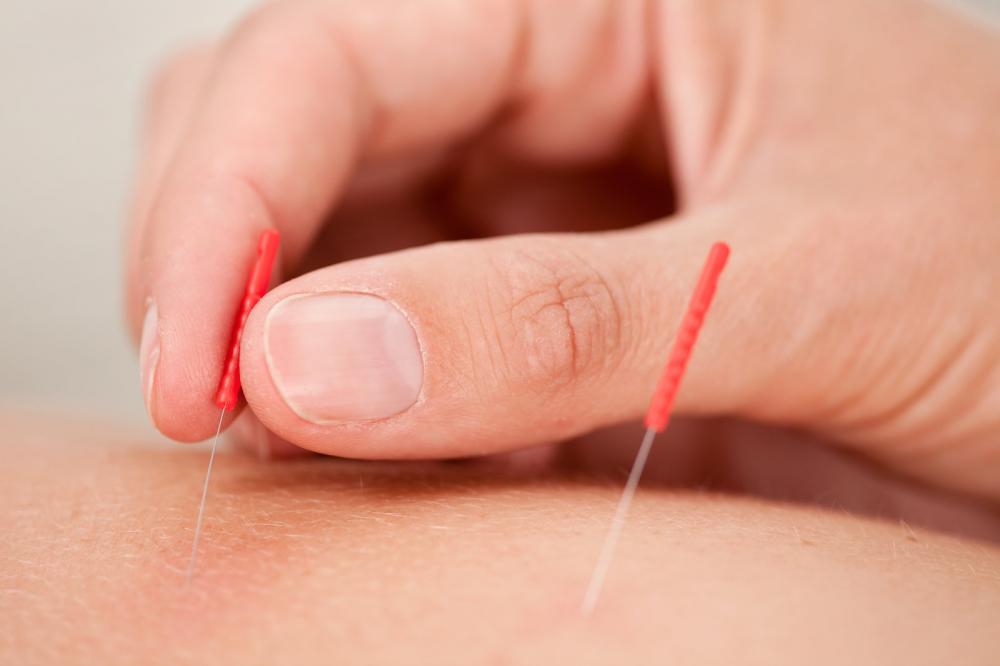 Acupuncture for nerve health